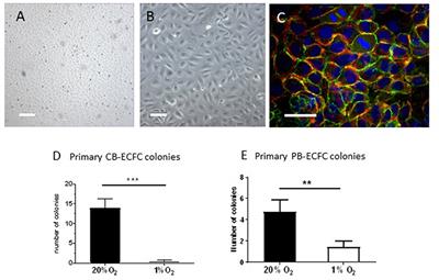 Hypoxia Impairs Initial Outgrowth of Endothelial Colony Forming Cells and Reduces Their Proliferative and Sprouting Potential